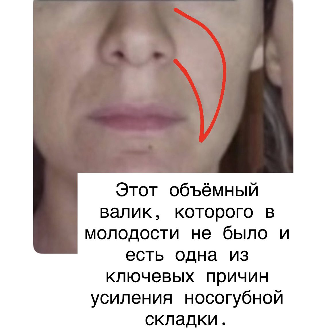 Массажная техника «Мастер Скульптор лица»
