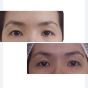 После массажа до и после результат