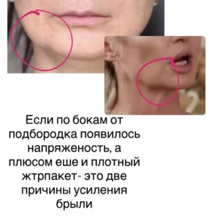 Массажная техника «Мастер глубокой коррекции Pro”- брыль