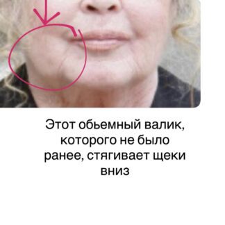 Массажная техника «Мастер Скульптор лица Pro”- брыль