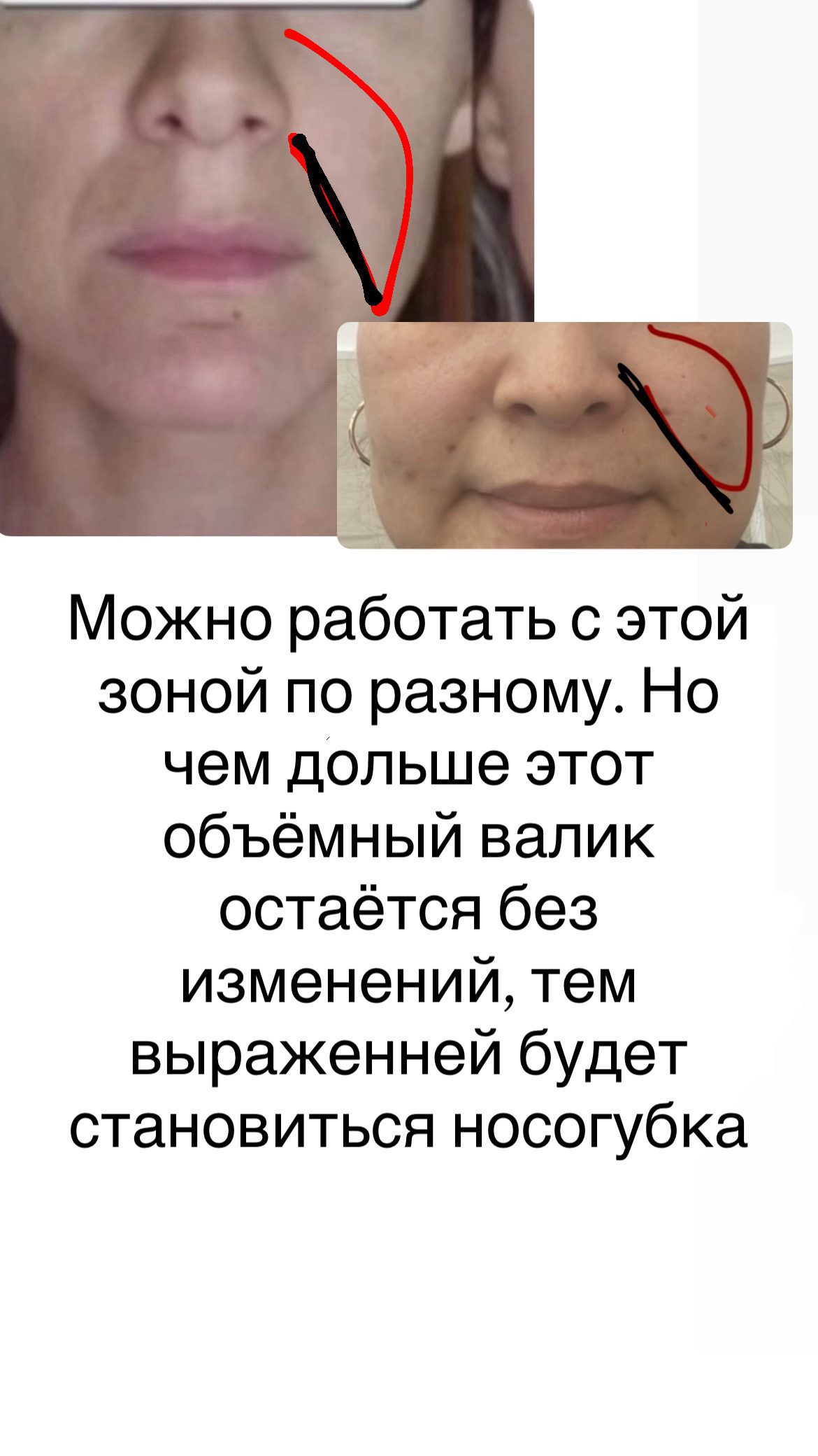 Массажная техника «Мастер Скульптор лица» — изображение 2