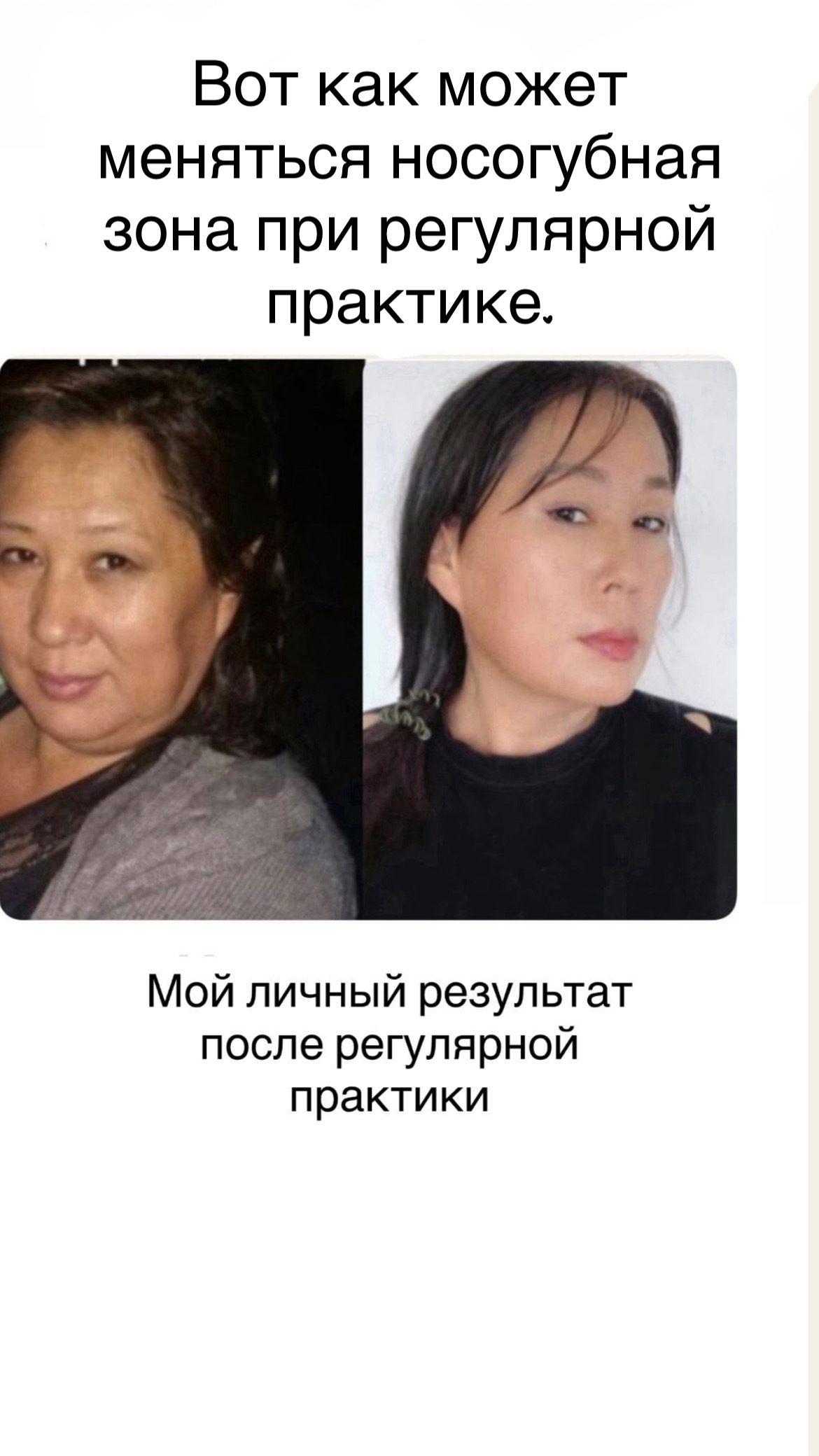 Массажная техника «Мастер Скульптор лица» — изображение 3